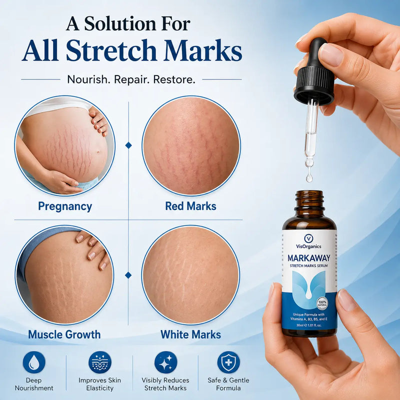 Mark Away Stretch Mark Serum | Vis Organics