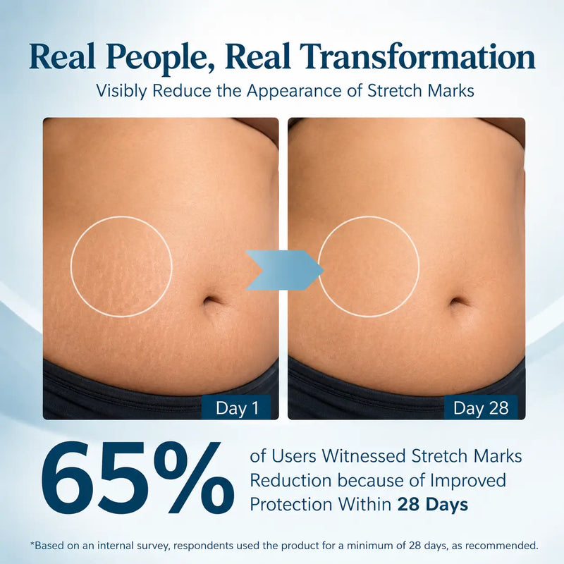 Mark Away Stretch Mark Serum | Vis Organics